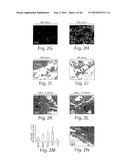 DYNAMIN MEDIATED DISEASES AND ASSOCIATED METHODS AND PRODUCTS diagram and image