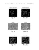 DYNAMIN MEDIATED DISEASES AND ASSOCIATED METHODS AND PRODUCTS diagram and image