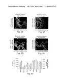 DYNAMIN MEDIATED DISEASES AND ASSOCIATED METHODS AND PRODUCTS diagram and image