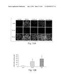 DYNAMIN MEDIATED DISEASES AND ASSOCIATED METHODS AND PRODUCTS diagram and image