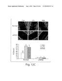 DYNAMIN MEDIATED DISEASES AND ASSOCIATED METHODS AND PRODUCTS diagram and image