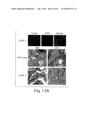 DYNAMIN MEDIATED DISEASES AND ASSOCIATED METHODS AND PRODUCTS diagram and image