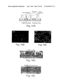 DYNAMIN MEDIATED DISEASES AND ASSOCIATED METHODS AND PRODUCTS diagram and image