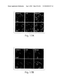 DYNAMIN MEDIATED DISEASES AND ASSOCIATED METHODS AND PRODUCTS diagram and image