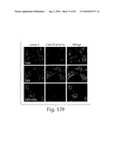 DYNAMIN MEDIATED DISEASES AND ASSOCIATED METHODS AND PRODUCTS diagram and image