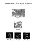 DYNAMIN MEDIATED DISEASES AND ASSOCIATED METHODS AND PRODUCTS diagram and image