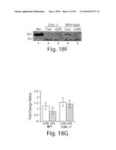 DYNAMIN MEDIATED DISEASES AND ASSOCIATED METHODS AND PRODUCTS diagram and image