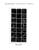 DYNAMIN MEDIATED DISEASES AND ASSOCIATED METHODS AND PRODUCTS diagram and image