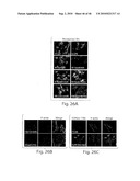 DYNAMIN MEDIATED DISEASES AND ASSOCIATED METHODS AND PRODUCTS diagram and image