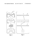 RESTORATION, RESTORATION COMPONENTS, AND METHODS OF MAKING A DENTAL RESTORATION diagram and image