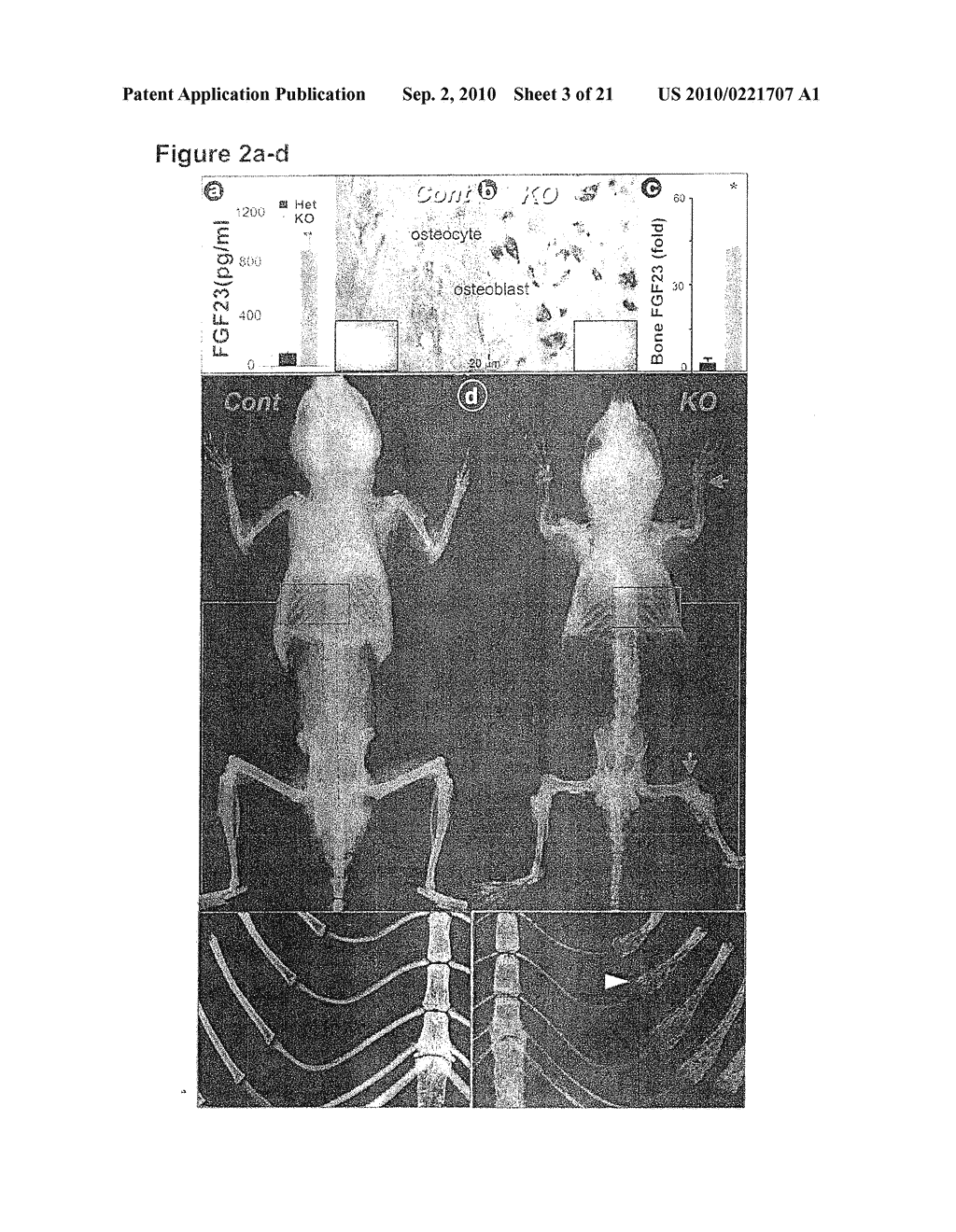 DIAGNOSTIC METHODS FOR DETECTING CONGENITAL BONE DEFECTS - diagram, schematic, and image 04