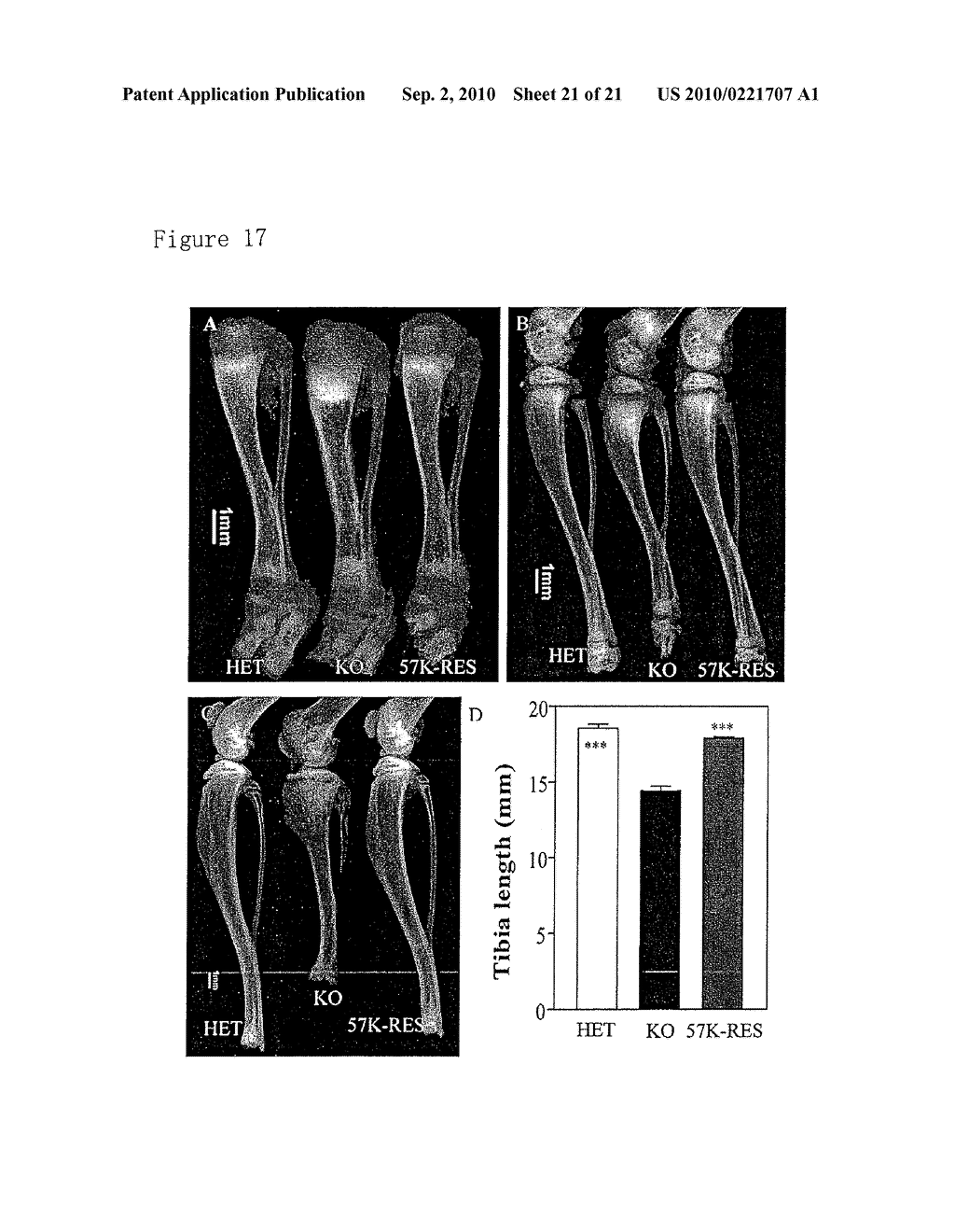 DIAGNOSTIC METHODS FOR DETECTING CONGENITAL BONE DEFECTS - diagram, schematic, and image 22