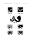 PATCHED POLYPEPTIDES AND USES RELATED THERETO diagram and image