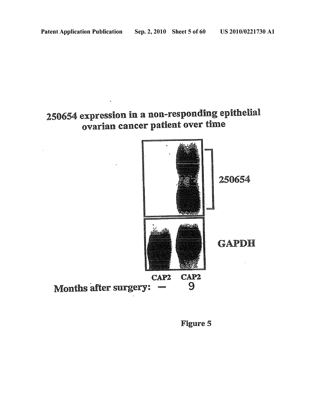 Methods for assessing SPARC Resistance, Disease Progression, and Treatment Efficacy in Ovarian Cancer - diagram, schematic, and image 06