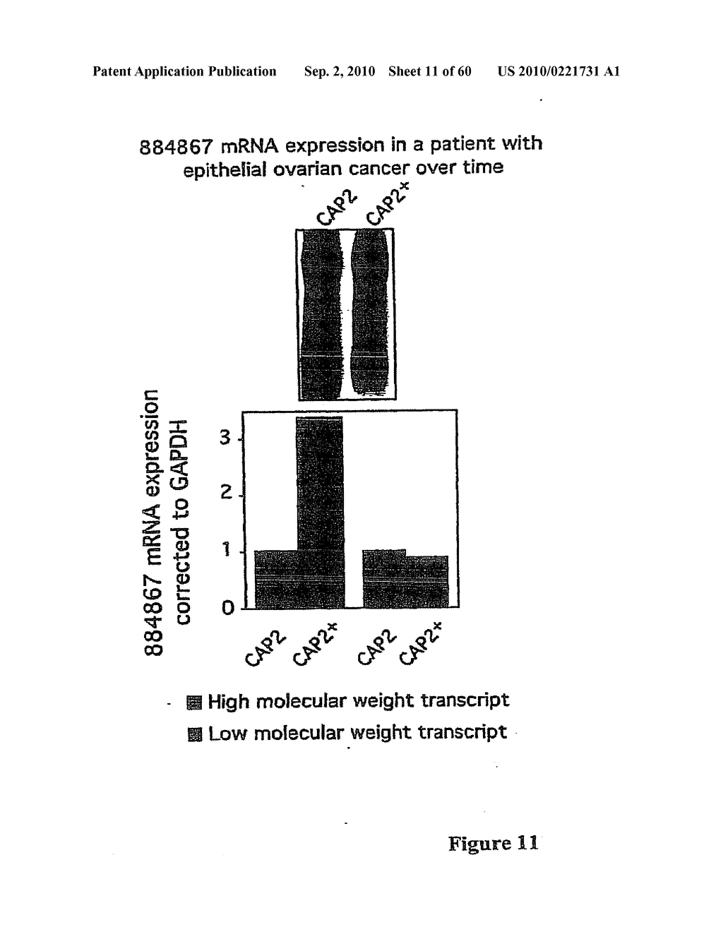 Methods for assessing MetAP2 Resistance, Disease Progression, and Treatment Efficacy in Ovarian Cancer - diagram, schematic, and image 12