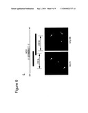 Translocation and Mutant ROS Kinase in Human Non-Small Cell Lung Carcinoma diagram and image