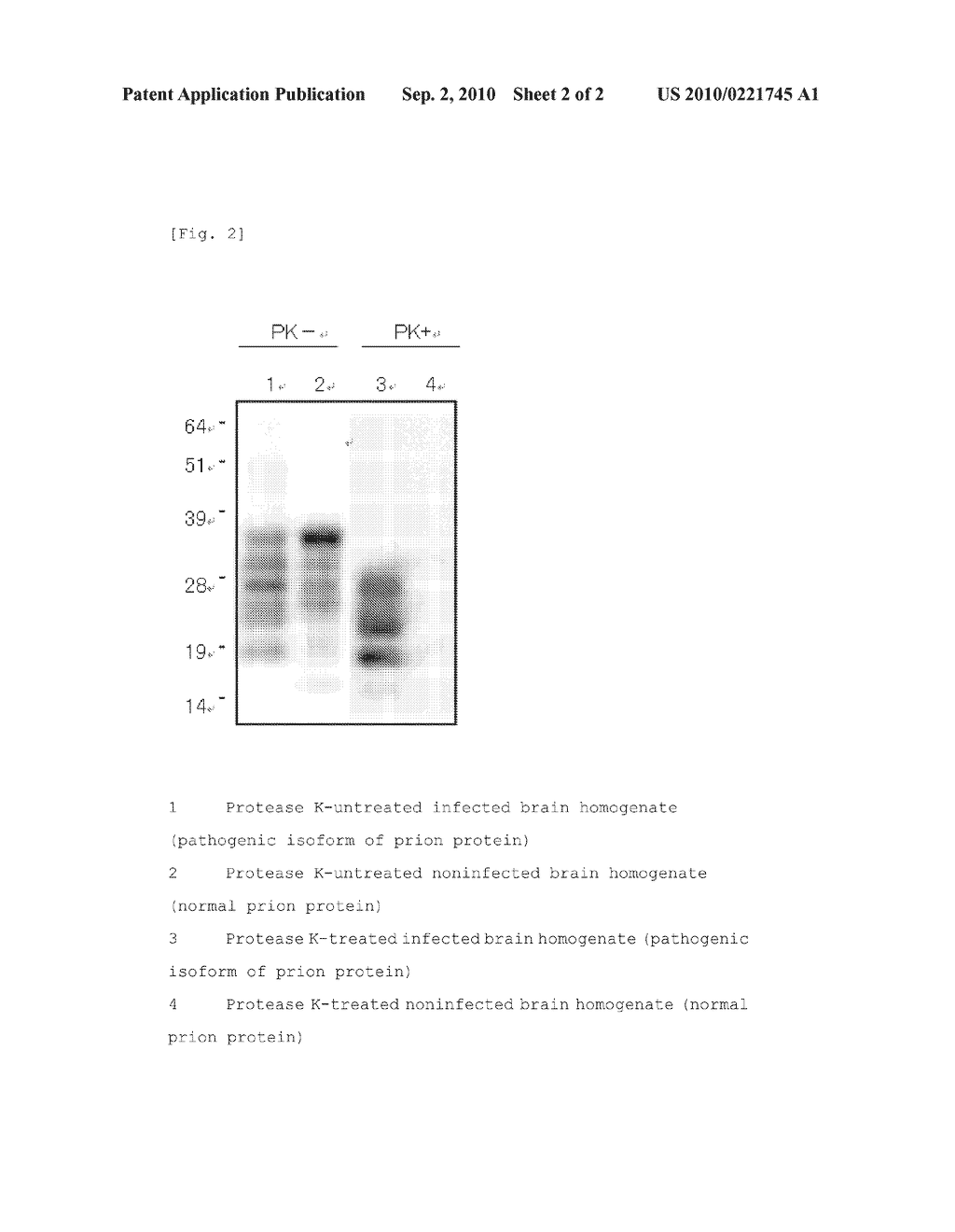 ABNORMAL PRION PROTEIN BINDER, AND METHOD FOR DETECTION OF ABNORMAL PRION PROTEIN - diagram, schematic, and image 03