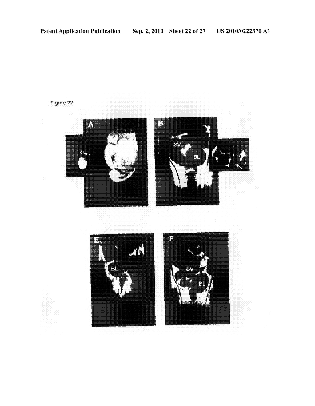 Methods of Treating Cancer - diagram, schematic, and image 23