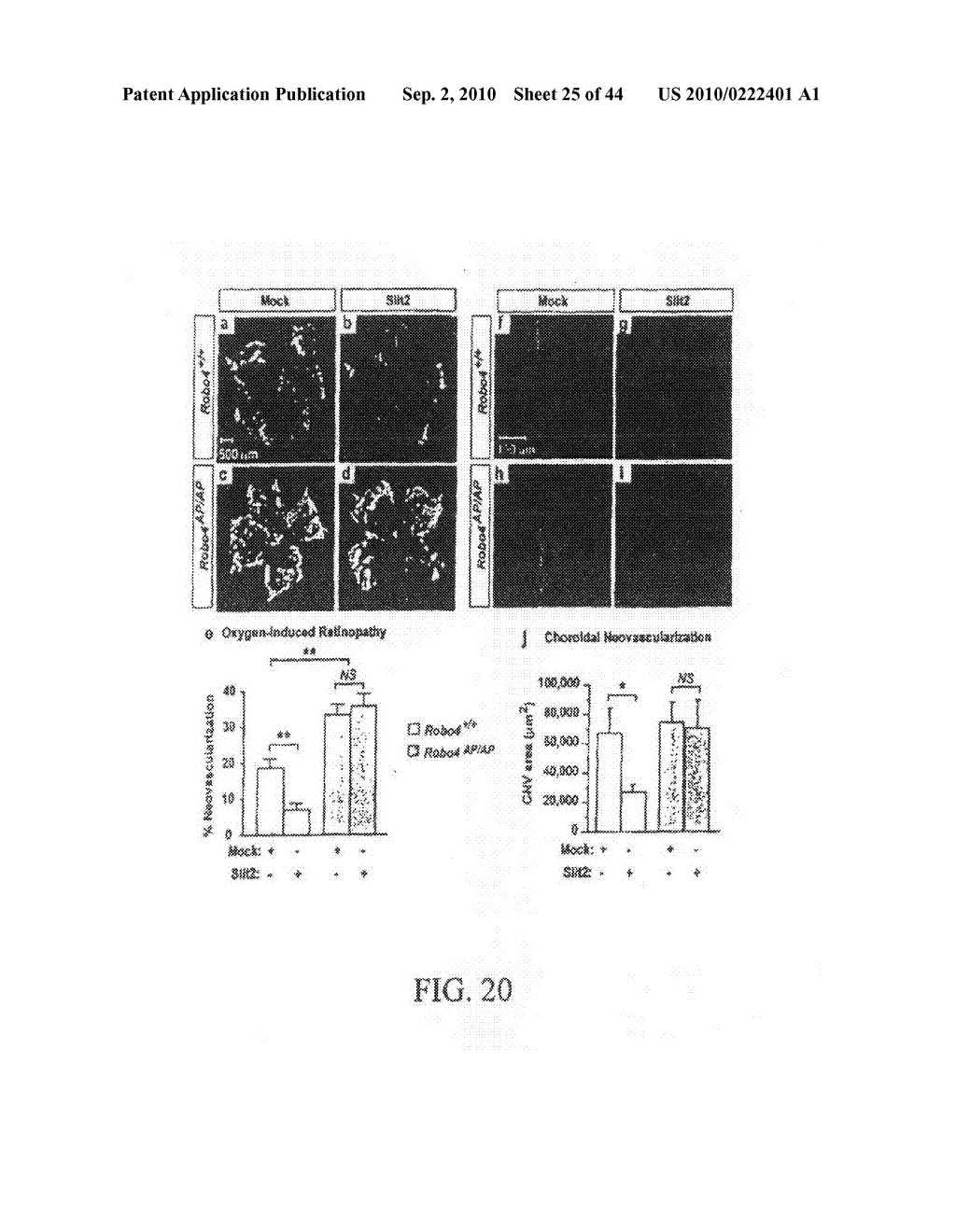 COMPOSITIONS AND METHODS FOR TREATING PATHOLOGIC ANGIOGENESIS AND VASCULAR PERMEABILITY - diagram, schematic, and image 26