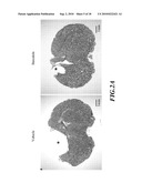 Usage of Baicalein in the Preparation of a Pharmaceutical Composition for the Treatment of Traumatic Brain Injury diagram and image