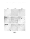 Usage of Baicalein in the Preparation of a Pharmaceutical Composition for the Treatment of Traumatic Brain Injury diagram and image