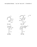 SYSTEMS AND METHODS FOR DELIVERING A MEDICAL IMPLANT TO AN ANATOMICAL LOCATION IN A PATIENT diagram and image