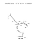 SYSTEMS AND METHODS FOR DELIVERING A MEDICAL IMPLANT TO AN ANATOMICAL LOCATION IN A PATIENT diagram and image