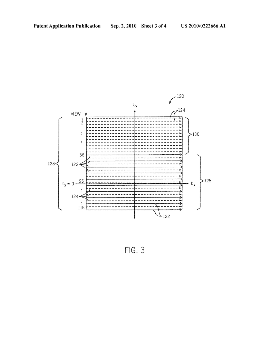 METHOD AND APPARATUS FOR BREATH-HELD MR DATA ACQUISITION USING INTERLEAVED ACQUISITION - diagram, schematic, and image 04