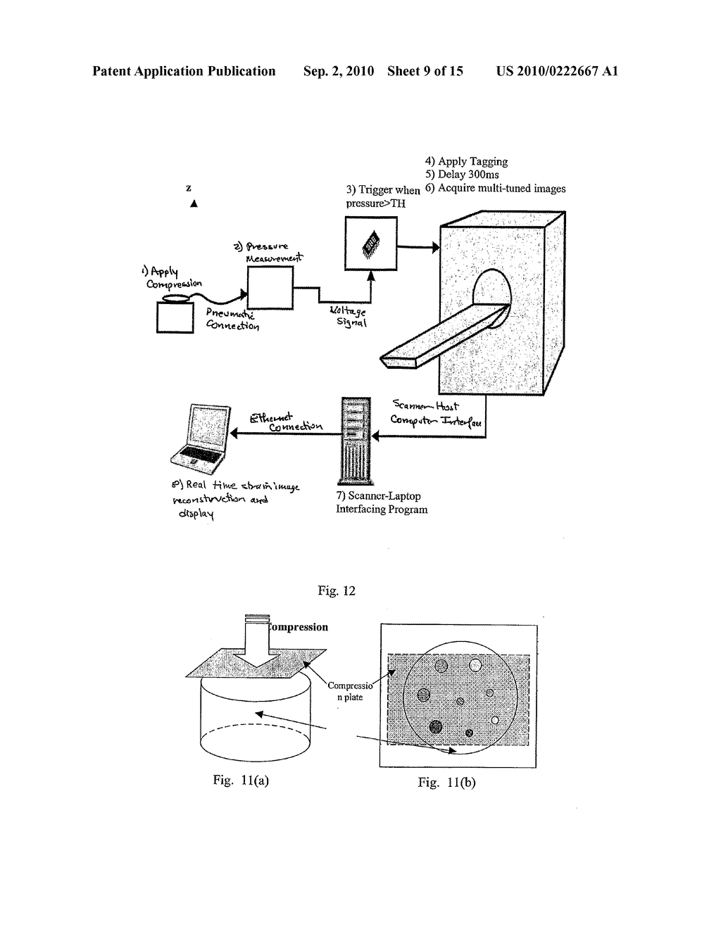 COMPRESSION DEVICE FOR ENHANCING NORMAL/ABNORMAL TISSUE CONTRAST IN MRI INCLUDING DEVICES AND METHODS RELATED THERETO - diagram, schematic, and image 10