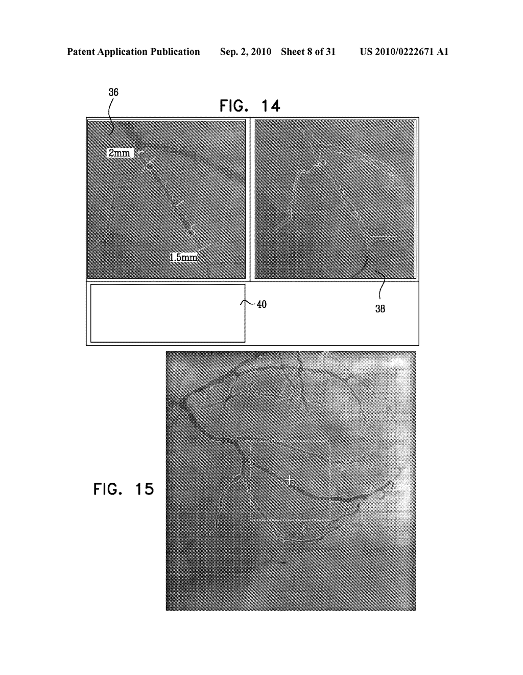 IDENTIFICATION AND PRESENTATION OF DEVICE-TO-VESSEL RELATIVE MOTION - diagram, schematic, and image 09