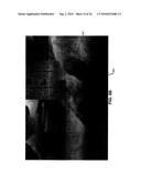 MINIATURE WIRELESS BIOMEDICAL TELEMETRY DEVICE diagram and image