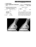 METHOD OF MEASURING QUALITY OF THE EQUINE DISTAL PHALLANGE FROM A LATERAL-MEDIAL RADIOGRAPH diagram and image