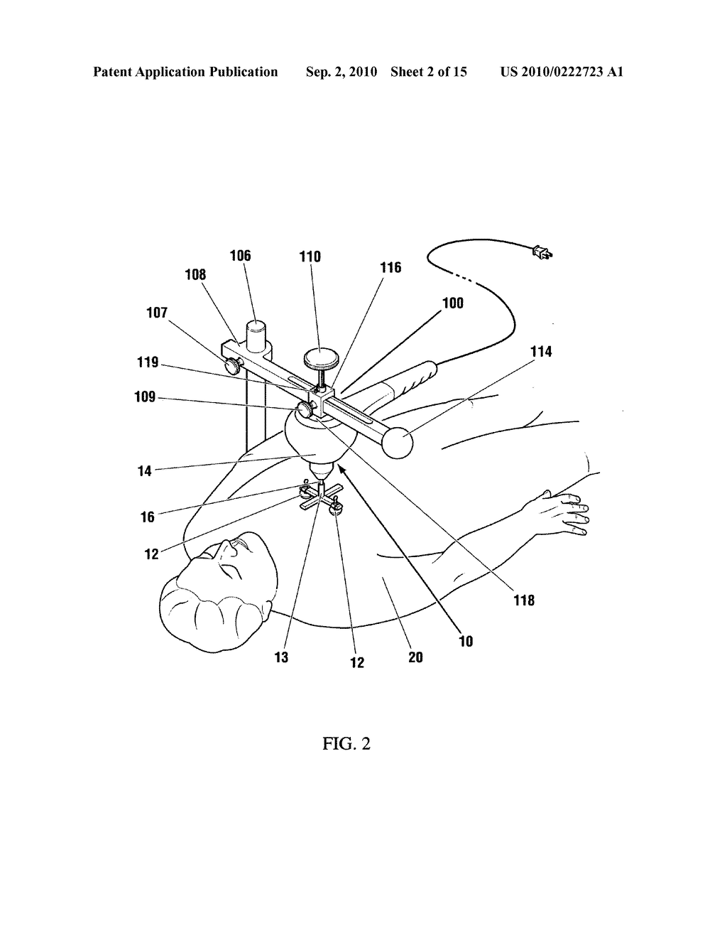 Vibration method for clearing acute arterial thrombotic occlusions in the emergency treatment of heart attack and stroke - diagram, schematic, and image 03