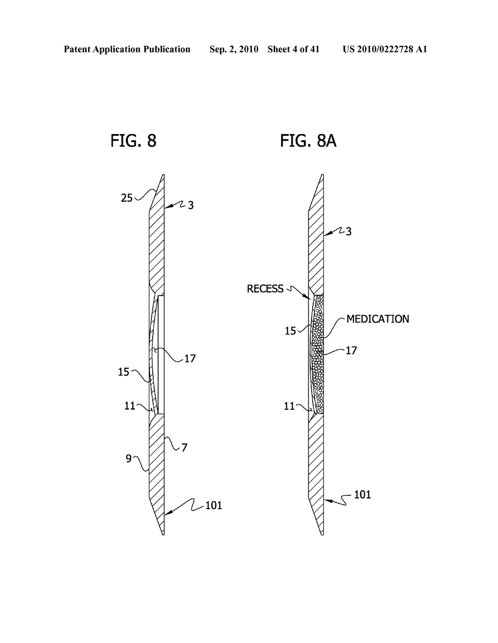 Body Pad - diagram, schematic, and image 05