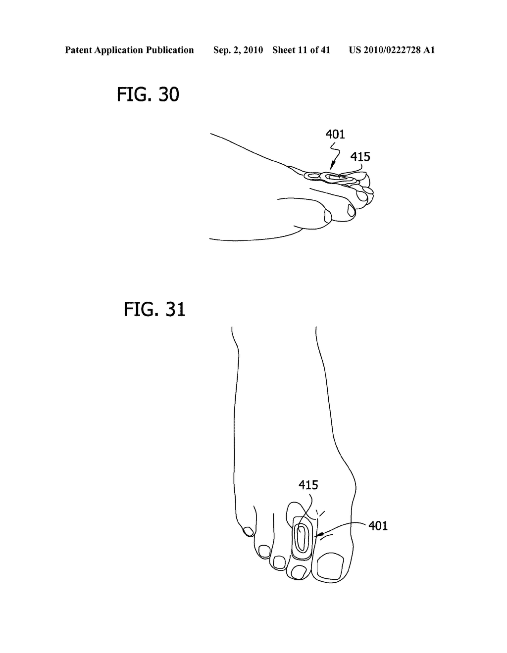 Body Pad - diagram, schematic, and image 12