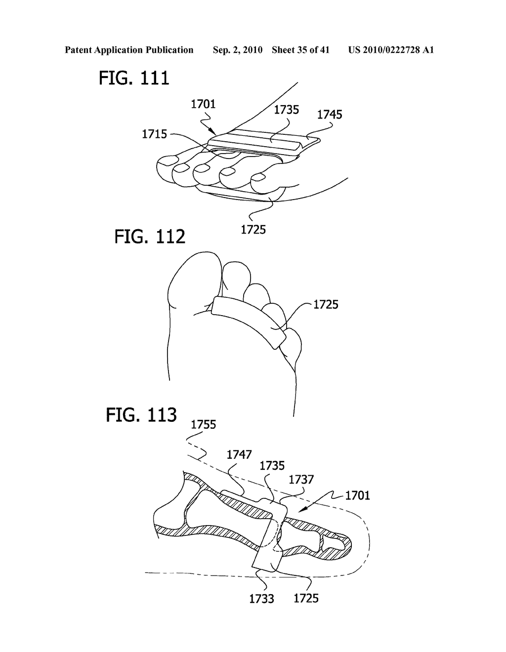 Body Pad - diagram, schematic, and image 36