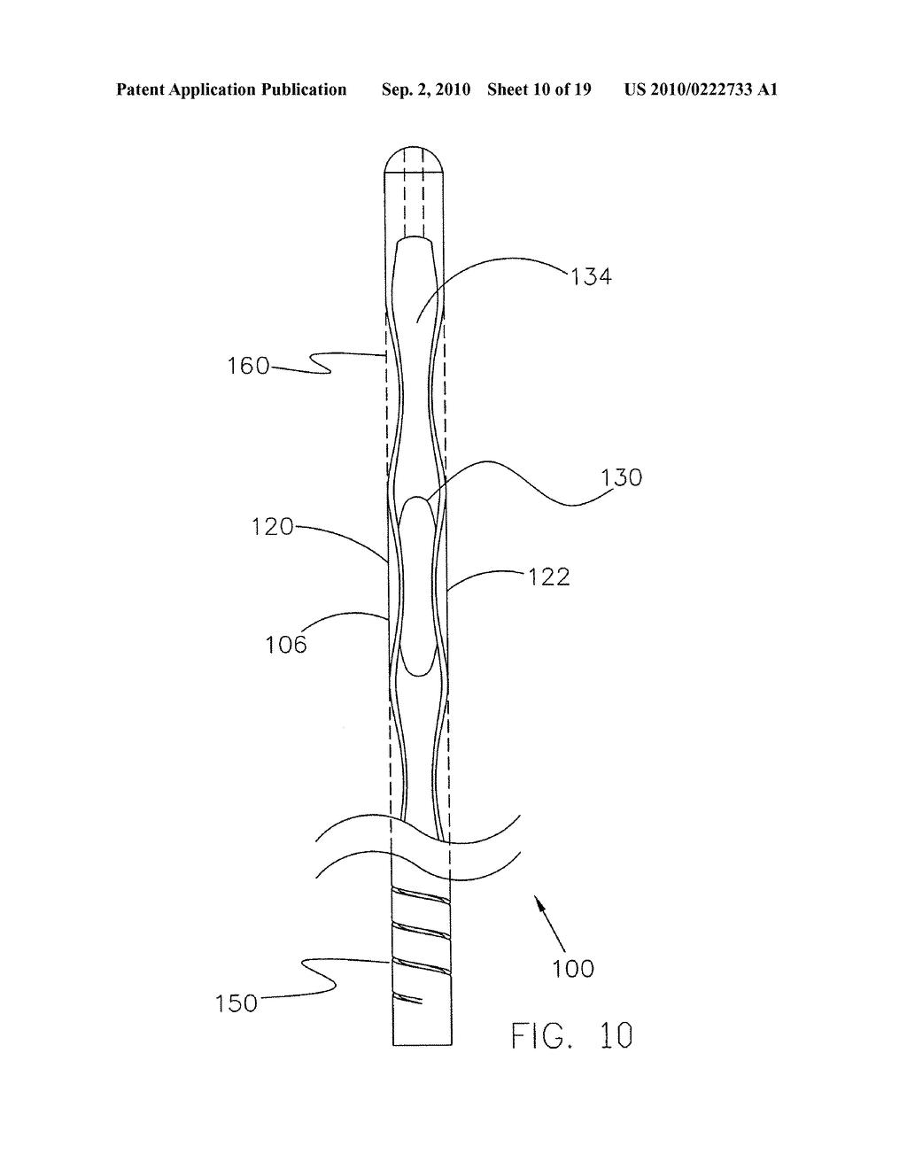 Glaucoma Treatment Method - diagram, schematic, and image 11