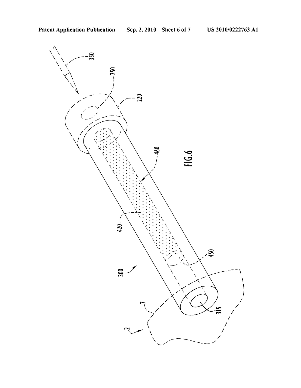Method and Apparatus to Indicate Prior Use of a Medical Item - diagram, schematic, and image 07