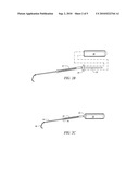 Intracranial Catheter and Methods of Use diagram and image