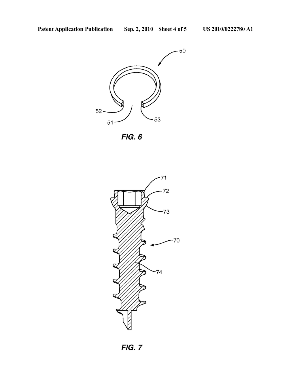 METHOD AND APPARATUS FOR RETAINING SCREW IN A PLATE - diagram, schematic, and image 05