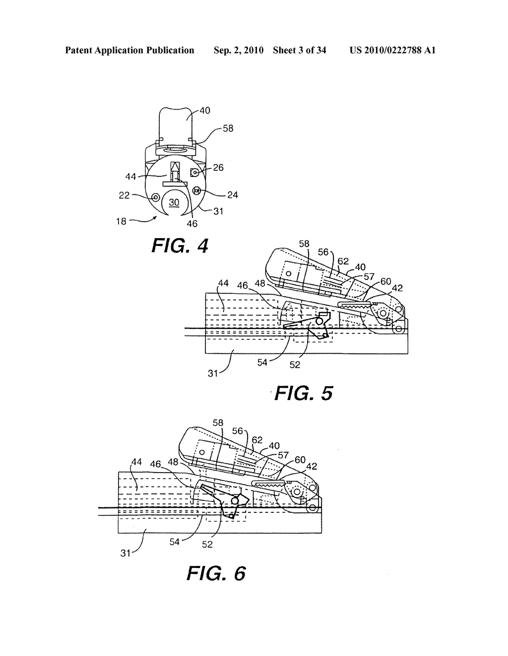 FLEXIBLE ENDOSCOPIC SURGICAL INSTRUMENT FOR INVAGINATION AND FUNDOPLICATION - diagram, schematic, and image 04