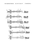 METHOD AND DEVICE FOR CLOSING HOLES IN TISSUE diagram and image