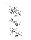 METHOD AND DEVICE FOR CLOSING HOLES IN TISSUE diagram and image