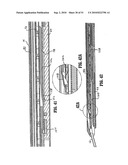 ENDOSCOPIC SURGICAL CLIP APPLIER diagram and image