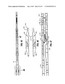 ENDOSCOPIC SURGICAL CLIP APPLIER diagram and image