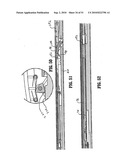 ENDOSCOPIC SURGICAL CLIP APPLIER diagram and image