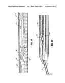 ENDOSCOPIC SURGICAL CLIP APPLIER diagram and image