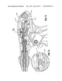 ENDOSCOPIC SURGICAL CLIP APPLIER diagram and image