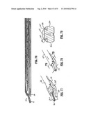 ENDOSCOPIC SURGICAL CLIP APPLIER diagram and image