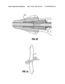 ENDOSCOPIC SURGICAL CLIP APPLIER diagram and image